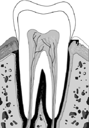 Grafik Zahn mit Wurzel